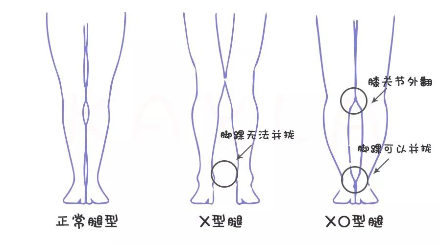 关于几个月的宝宝腿能伸直的问题解析